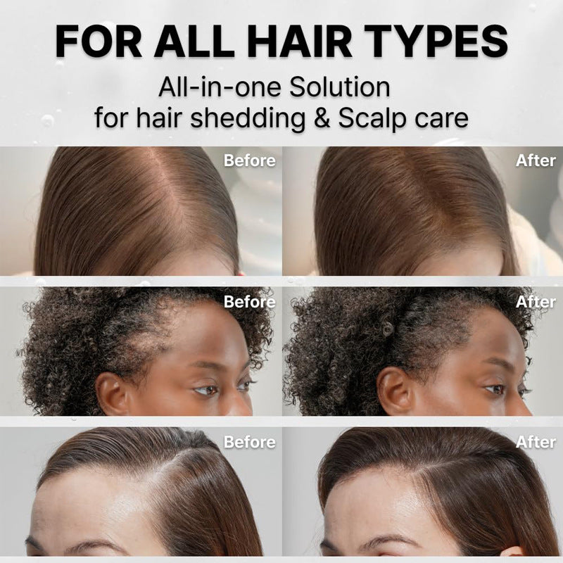 FollicFlow Hair Growth Serum & Scalp Massage Brush