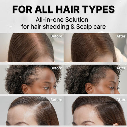 FollicFlow Hair Growth Serum & Scalp Massage Brush